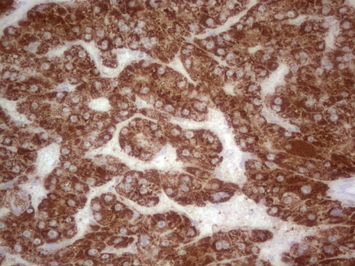 m07133 anti abat mouse monoclonal antibody clone id oti7h1 ihc testing 4
