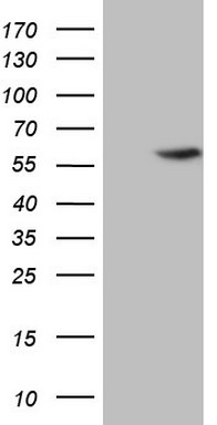 m07133 anti abat mouse monoclonal antibody clone id oti7h1 wb testing 1