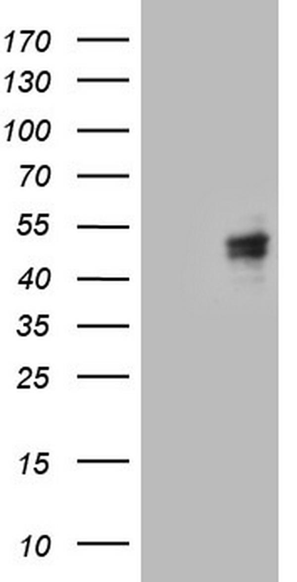 HEK293T cells were transfected with the pCMV6-ENTRY control (Left lane) or pCMV6-ENTRY CANT1 (Right lane) cDNA for 48 hrs and lysed