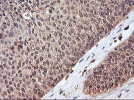 m07155 anti serpinb6 mouse monoclonal antibody clone id oti1c5 ihc testing 6