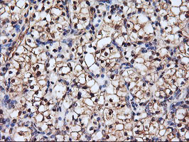 m07155 anti serpinb6 mouse monoclonal antibody clone id oti1c5 ihc testing 7