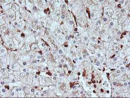 m07155 anti serpinb6 mouse monoclonal antibody clone id oti1c5 ihc testing 8