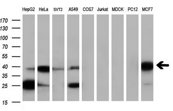 m07155 anti serpinb6 mouse monoclonal antibody clone id oti1c5 wb testing 3