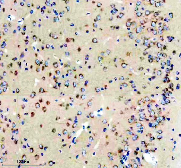 IHC analysis of Calsyntenin-1/CLSTN1 using anti-Calsyntenin-1/CLSTN1 antibody (M07157)