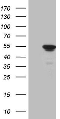 HEK293T cells were transfected with the pCMV6-ENTRY control (Left lane) or pCMV6-ENTRY ELP4 (Right lane) cDNA for 48 hrs and lysed