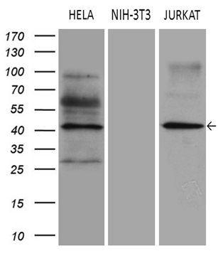 Western blot analysis of extracts (35ug) from 3 different cell lines by using anti-ELP4 monoclonal antibody (1:500)