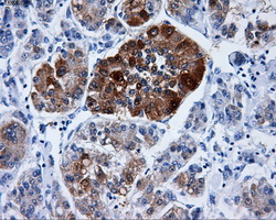 m07170 anti dcxr mouse monoclonal antibody clone id oti4d11 ihc testing 2