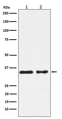 Western blot analysis of CSNK1A1 expression in (1) MCF7 cell lysate; (2) NIH/3T3 cell lysate