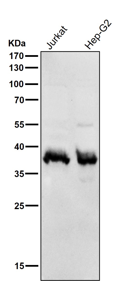 All lanes use the Antibody at 1:3k dilution for 1 hour at room temperature