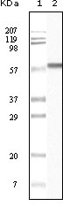 Western Blot analysis using Casein Kinase Iα Monoclonal Antibody against truncated CK1 recombinant protein