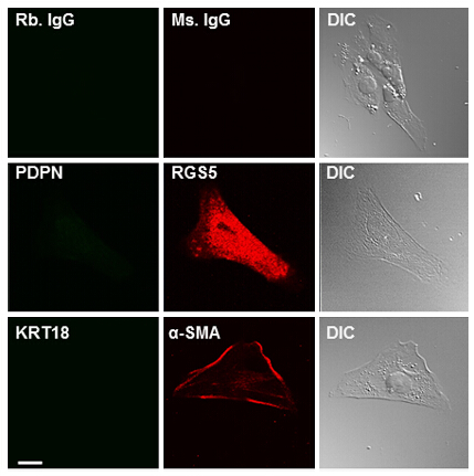 m07178 anti rgs5 mouse monoclonal antibody clone id oti1c1 if testing 6