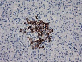 m07178 anti rgs5 mouse monoclonal antibody clone id oti1c1 ihc testing 2