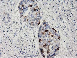 m07178 anti rgs5 mouse monoclonal antibody clone id oti1c1 ihc testing 3