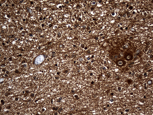 Immunohistochemical staining of paraffin-embedded Human embryonic cerebellum within the normal limits using anti-GNPAT mouse monoclonal antibody