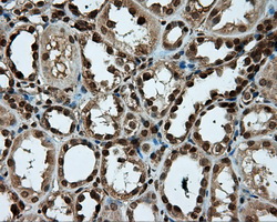 m07208 1 anti psmc3 mouse monoclonal antibody clone id oti1c10 ihc testing 4