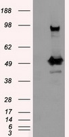 HEK293T cells were transfected with the pCMV6-ENTRY control (Left lane) or pCMV6-ENTRY PSMC3 (Right lane) cDNA for 48 hrs and lysed