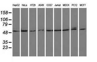 Western blot analysis of extracts (35ug) from 9 different cell lines by using anti-PSMC3 monoclonal antibody