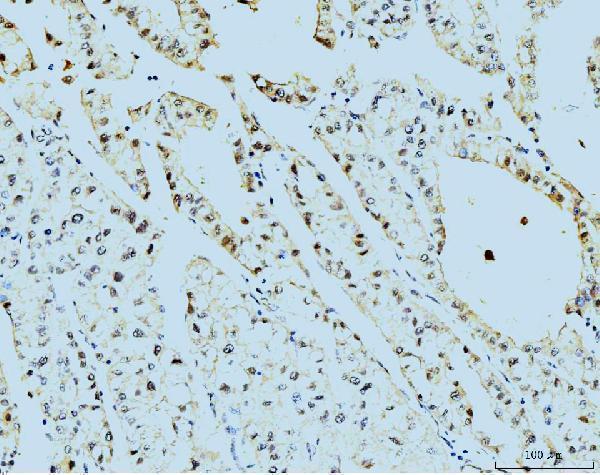  IHC analysis of TBP-1/PSMC3 using anti-TBP-1/PSMC3 antibody (M07208-2)