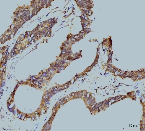  IHC analysis of TBP-1/PSMC3 using anti-TBP-1/PSMC3 antibody (M07208-2)