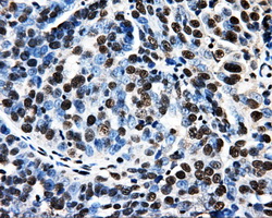 m07208 anti psmc3 mouse monoclonal antibody clone id oti9f3 ihc testing 3