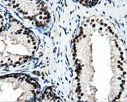 m07208 anti psmc3 mouse monoclonal antibody clone id oti9f3 ihc testing 4