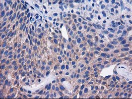 m07212 anti sult1c2 mouse monoclonal antibody clone id oti4g1 ihc testing 10