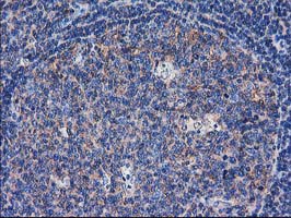 m07212 anti sult1c2 mouse monoclonal antibody clone id oti4g1 ihc testing 11