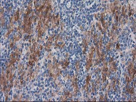 m07212 anti sult1c2 mouse monoclonal antibody clone id oti4g1 ihc testing 12