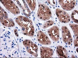 m07212 anti sult1c2 mouse monoclonal antibody clone id oti4g1 ihc testing 13