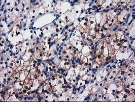 m07212 anti sult1c2 mouse monoclonal antibody clone id oti4g1 ihc testing 14