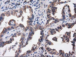 m07212 anti sult1c2 mouse monoclonal antibody clone id oti4g1 ihc testing 2