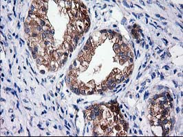 m07212 anti sult1c2 mouse monoclonal antibody clone id oti4g1 ihc testing 3