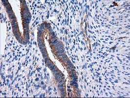 m07212 anti sult1c2 mouse monoclonal antibody clone id oti4g1 ihc testing 6
