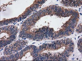 m07212 anti sult1c2 mouse monoclonal antibody clone id oti4g1 ihc testing 7