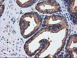 m07212 anti sult1c2 mouse monoclonal antibody clone id oti4g1 ihc testing 8
