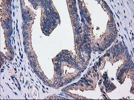 m07212 anti sult1c2 mouse monoclonal antibody clone id oti4g1 ihc testing 9