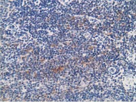 m07227 anti prkar1b mouse monoclonal antibody clone id oti2a3 ihc testing 2