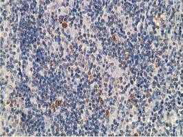 m07227 anti prkar1b mouse monoclonal antibody clone id oti2a3 ihc testing 3