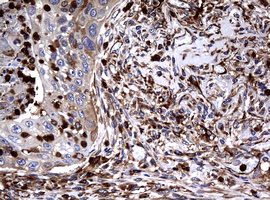 m07245 anti rasgrp3 mouse monoclonal antibody clone id oti2c11 ihc testing 2