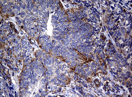 m07245 anti rasgrp3 mouse monoclonal antibody clone id oti2c11 ihc testing 4