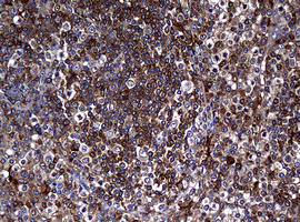 m07245 anti rasgrp3 mouse monoclonal antibody clone id oti2c11 ihc testing 5