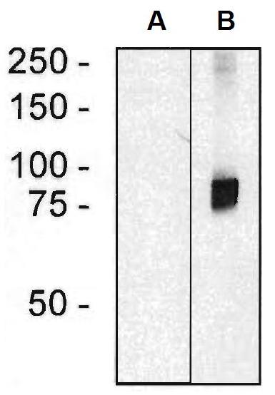 Western blotting analysis of ARHGEF4 in HEK293 cells (A) and HEK293-ARHGEF4 transfectants (B) using mouse monoclonal anti-ARHGEF4 (clone ARHGEF-08)