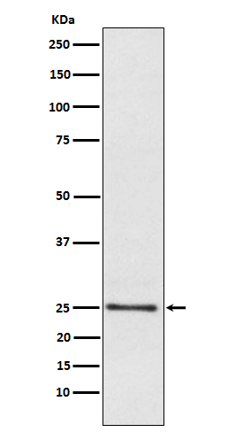Western blot analysis of Lysophospholipase 1 expression in Human fetal liver lysate