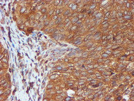 m07267 3 anti erp72 pdia4 mouse monoclonal antibody clone id oti2b9 ihc testing 5