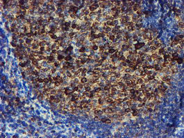 Immunohistochemical staining of paraffin-embedded Human tonsil within the normal limits using anti-PDIA4 mouse monoclonal antibody