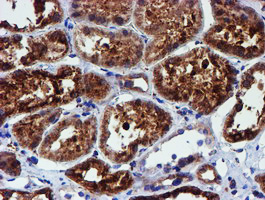 m07267 anti erp72 pdia4 mouse monoclonal antibody clone id oti2c11 ihc testing 13
