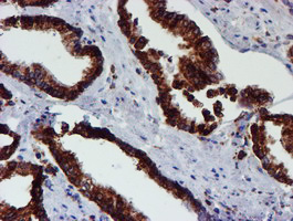 m07267 anti erp72 pdia4 mouse monoclonal antibody clone id oti2c11 ihc testing 7