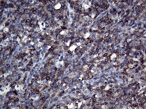 m07280 anti riam apbb1ip mouse monoclonal antibody clone id oti6e3 ihc testing 3