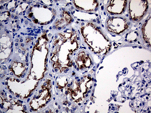 m07280 anti riam apbb1ip mouse monoclonal antibody clone id oti6e3 ihc testing 4