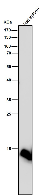 All lanes use the Antibody at 1:5K dilution for 1 hour at room temperature